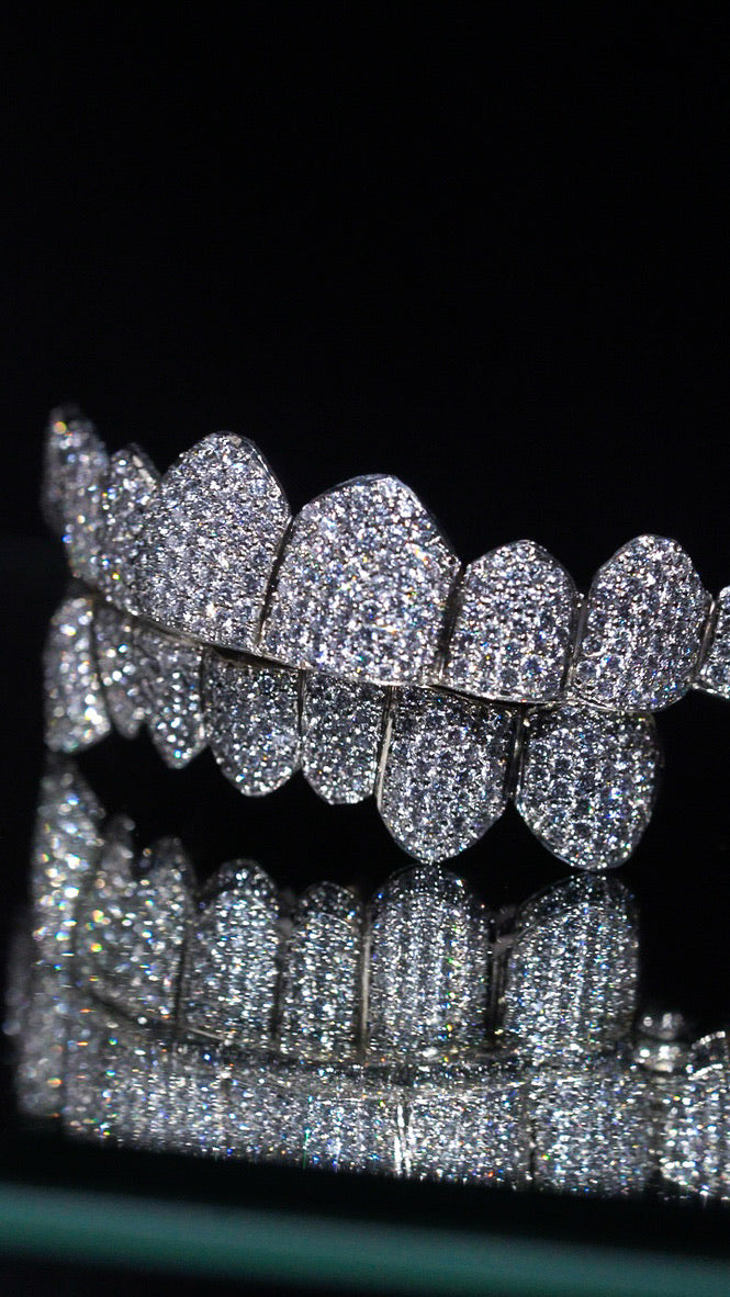 How Much Do Grillz Cost in Las Vegas? Complete 2026 Price Guide