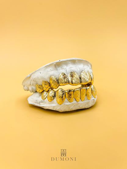 Solid Gold Grillz